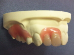 軟性義歯